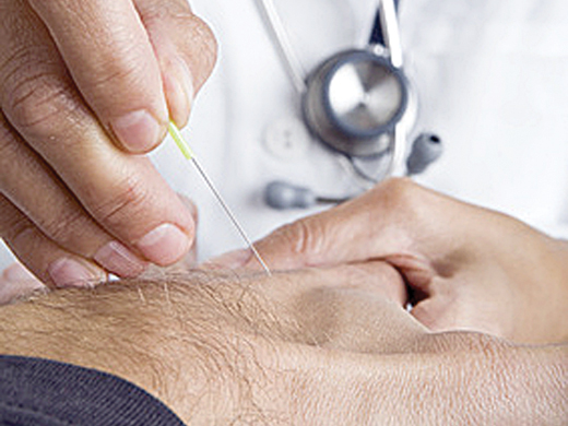 Health News – Defending acupuncture – new treatment centre says Chinese needle therapy can cure illness Akupunktur