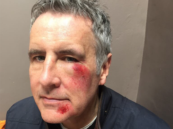 Dermot Murnaghan injury