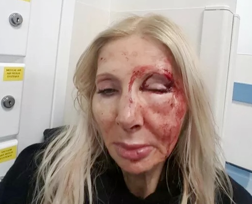 Police appeal after vicious attack on visitor from Austria Warwick Avenue attack appeal