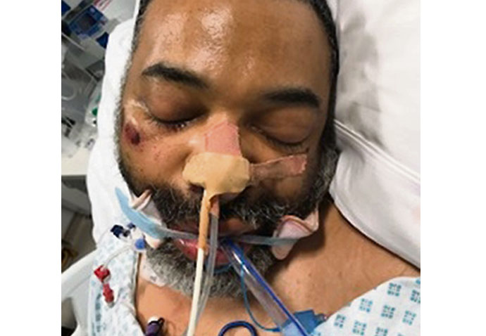 Police in bid to identify mystery coma man Coma man euston