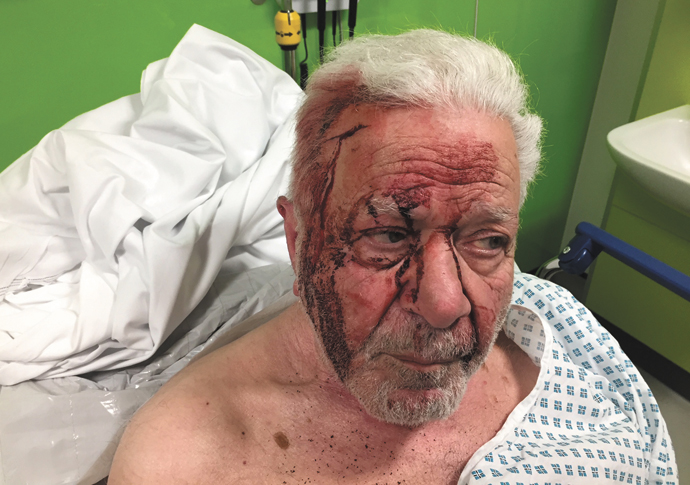 Assault Victim injuries
