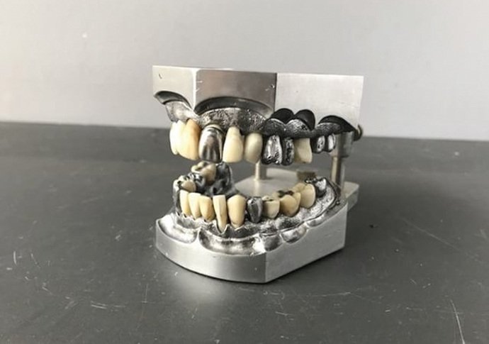 Toothache patients struggling after dentists move to emergency treatment only Teeth_0459