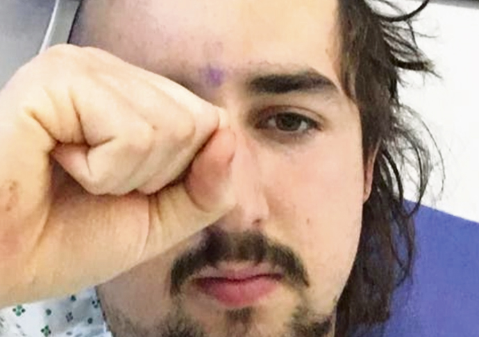 Student bike victim’s back on his course Billy Draper-Barr (22)