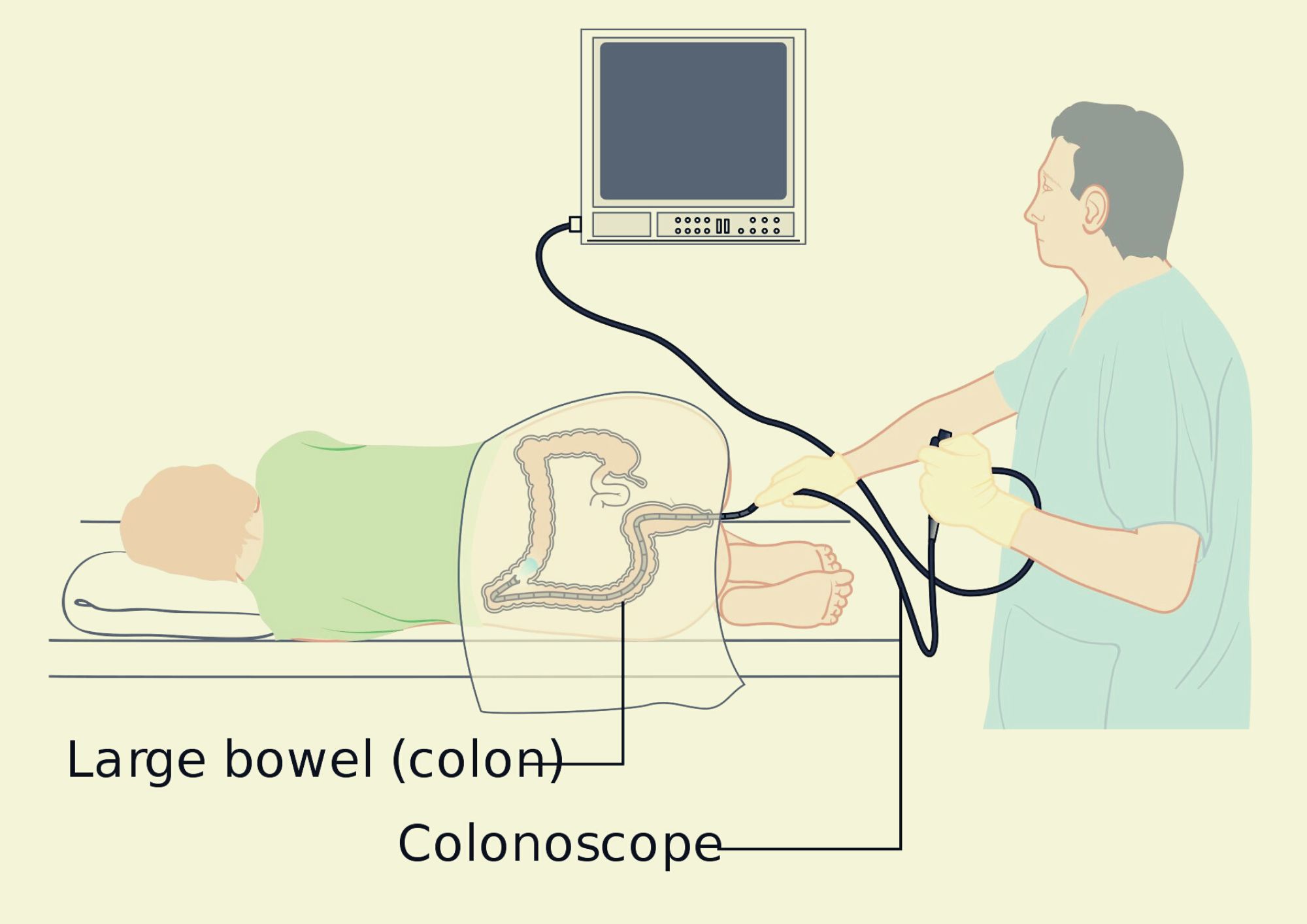 John Gulliver: Maybe colonoscopy should’ve been live-streamed for the NHS peter brown johanna (1)